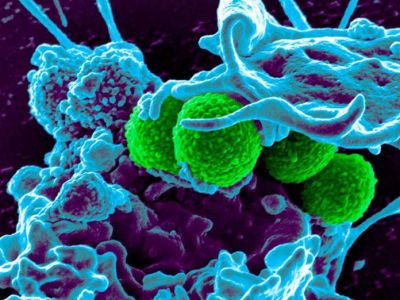 Siêu kháng sinh mới – Vancomycin 3.0